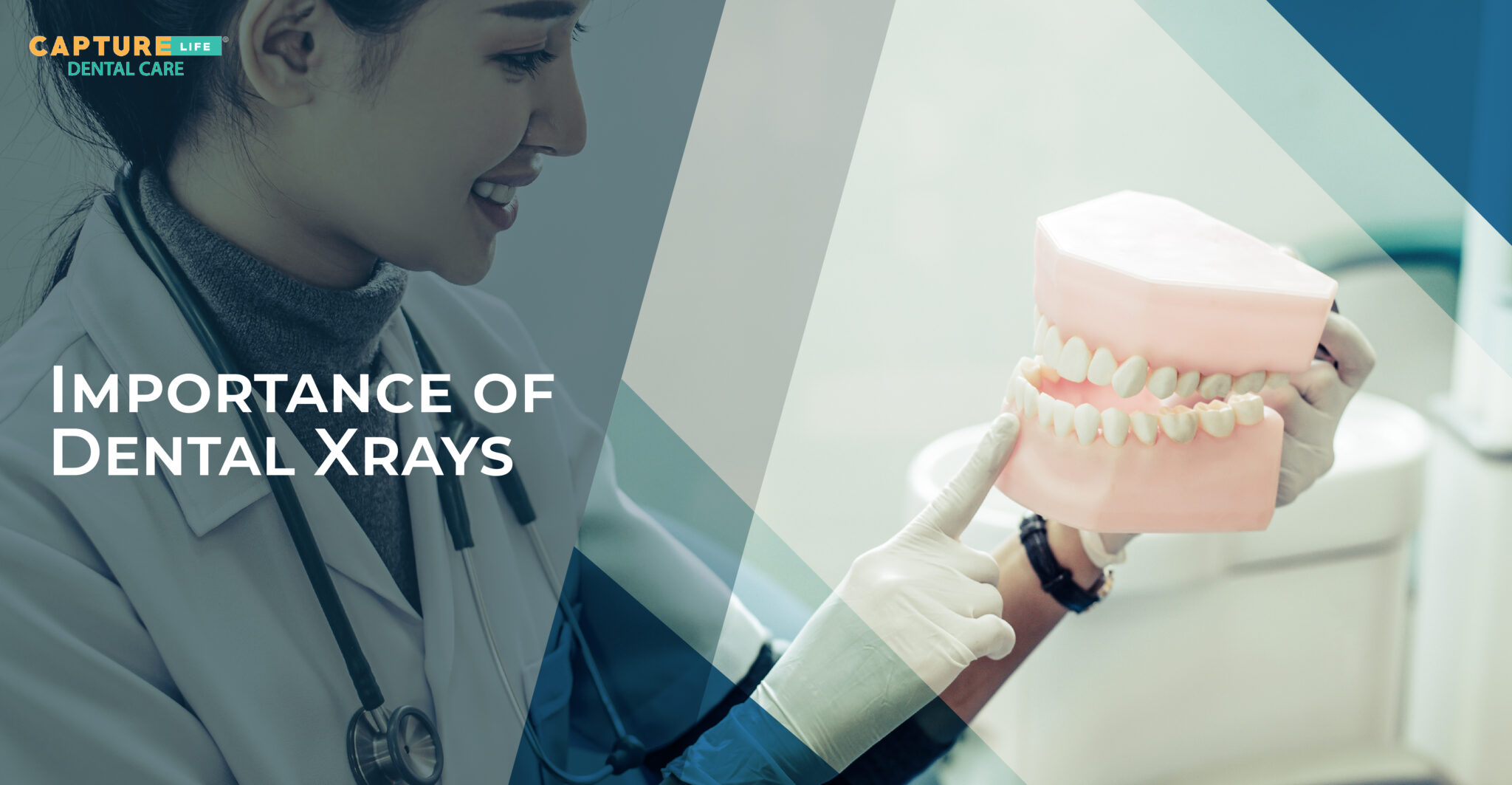 Unveiling the Power of Dental X-Rays: A Comprehensive Guide to Your 